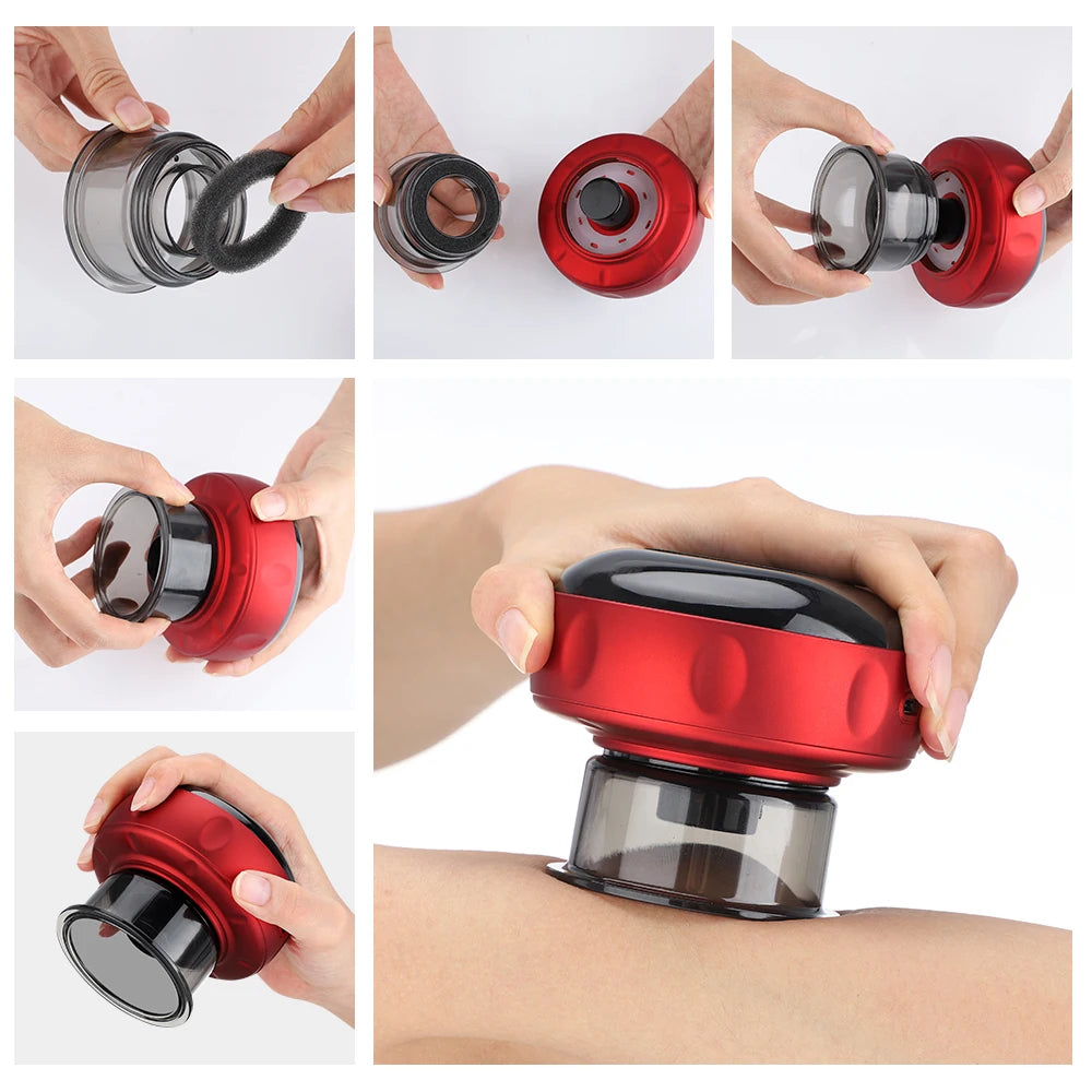 MS Smart Cupping Bundle