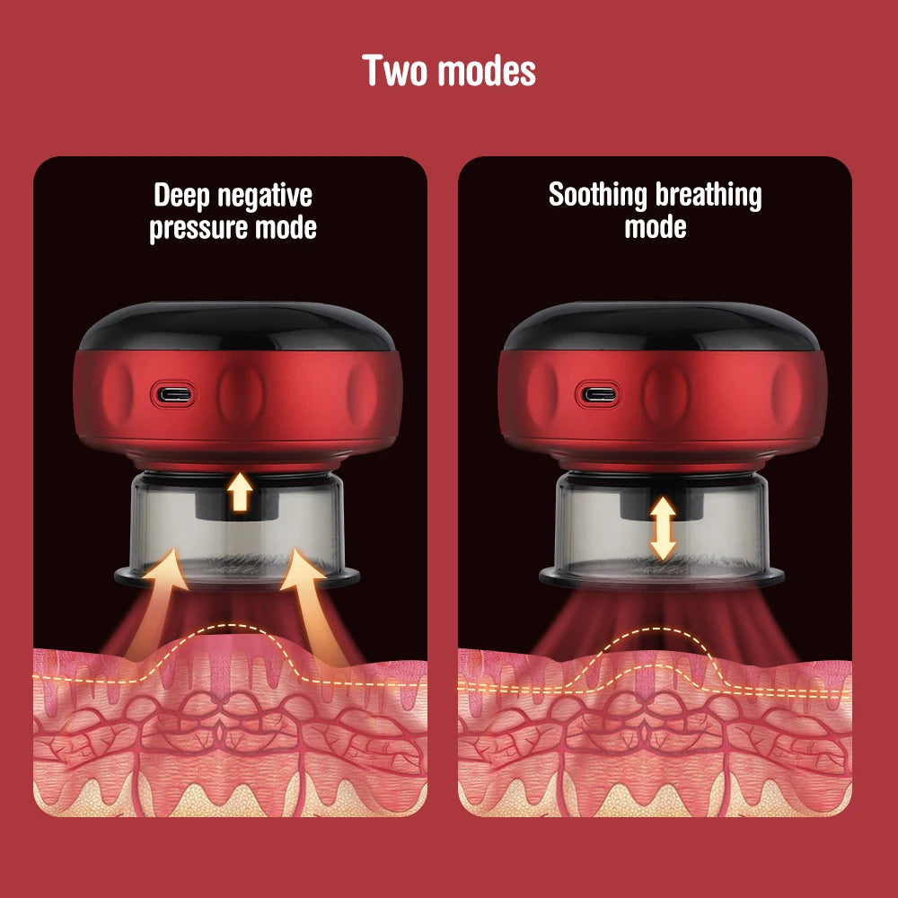 MS Smart Cupping Bundle
